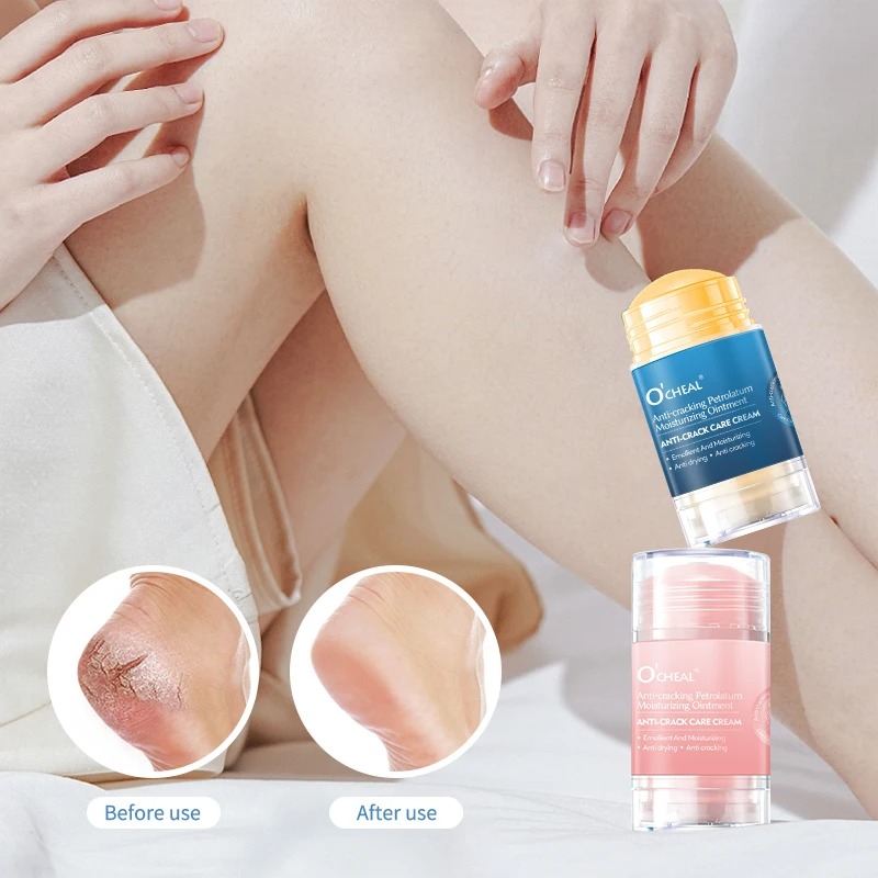 Anti Crack Foot Cream For Dry  - Heels review and price
